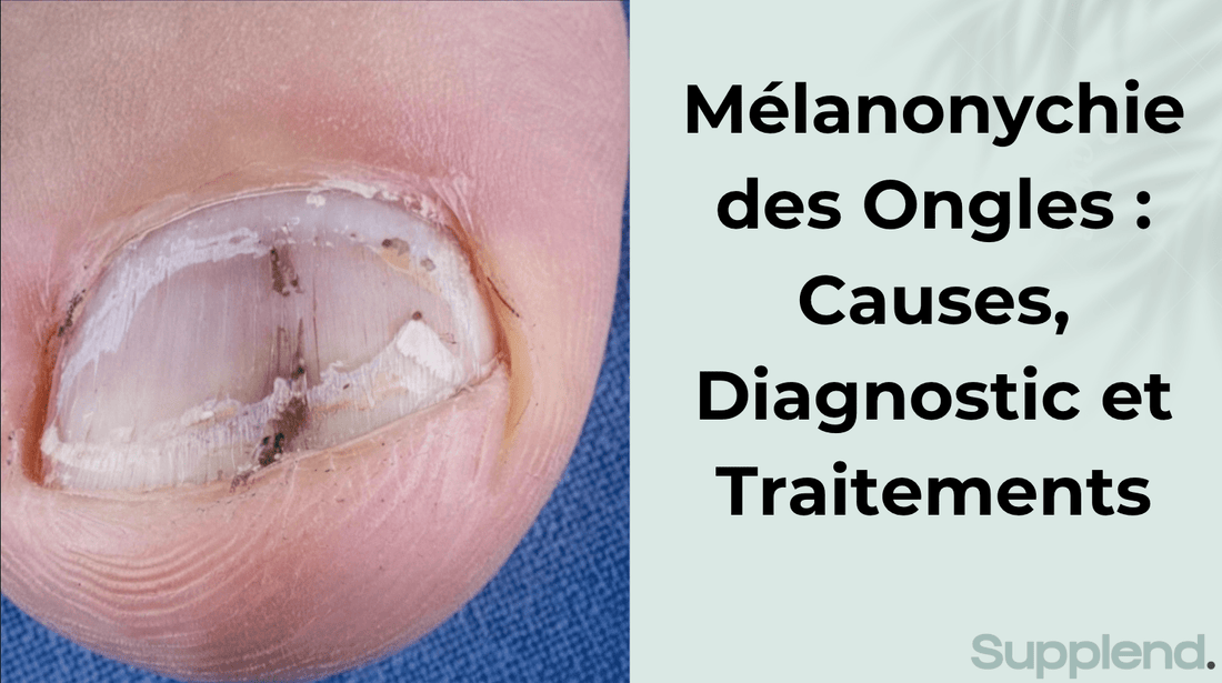 Mélanonychie des Ongles : Causes, Diagnostic et Traitements