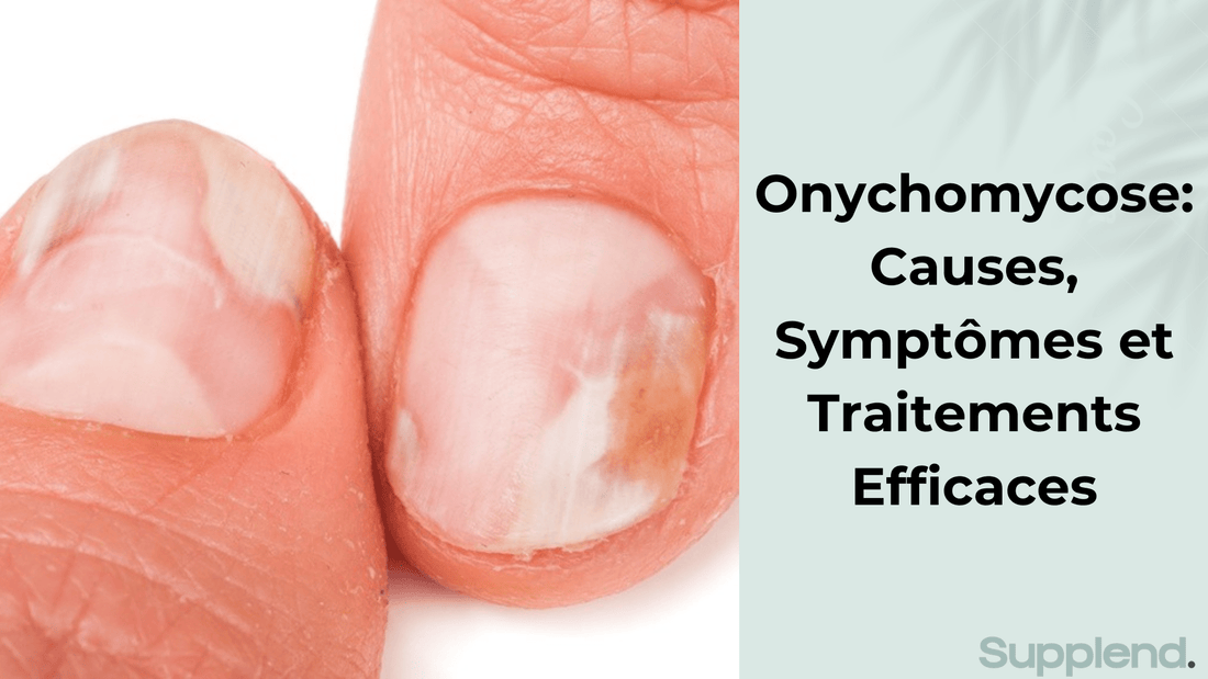 Onychomycose: Causes, Symptômes et Traitements Efficaces