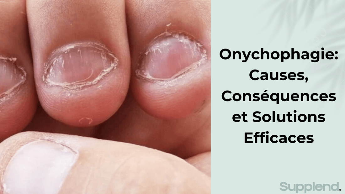 Onychophagie: Causes, Conséquences et Solutions Efficaces