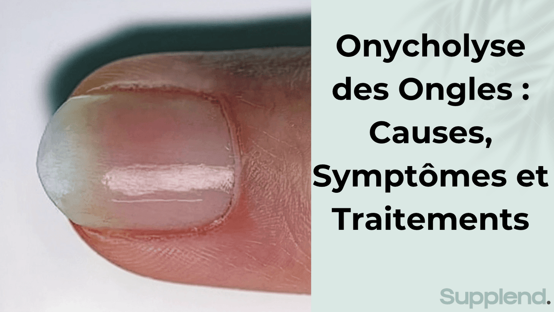 Onycholyse des Ongles : Causes, Symptômes et Traitements